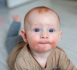 האם ניתוח קיסרי משפיע על בריאות התינוק?-תמונה